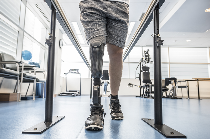 Man with prosthetic leg walking and exercising through rehabilitation and physical therapy.